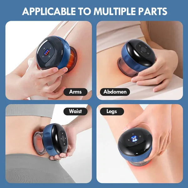 Cupping Therapy Pro™ - Alivio en minutos!