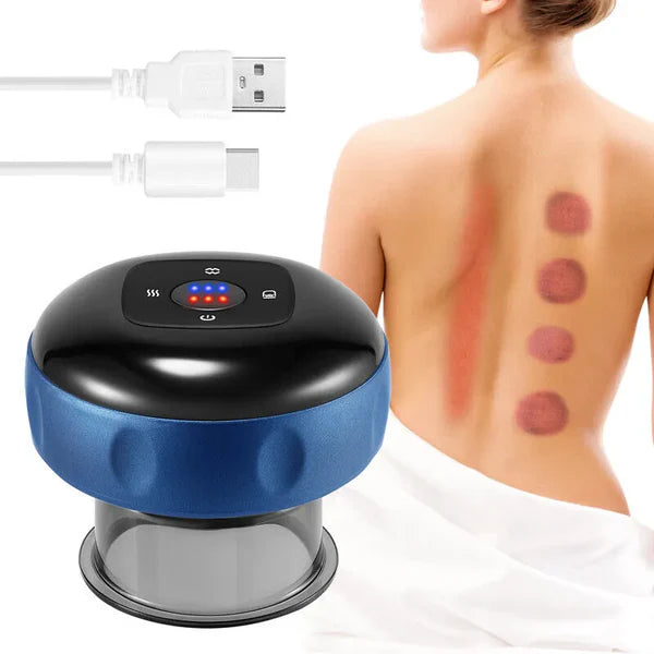 Cupping Therapy Pro™ - Alivio en minutos!