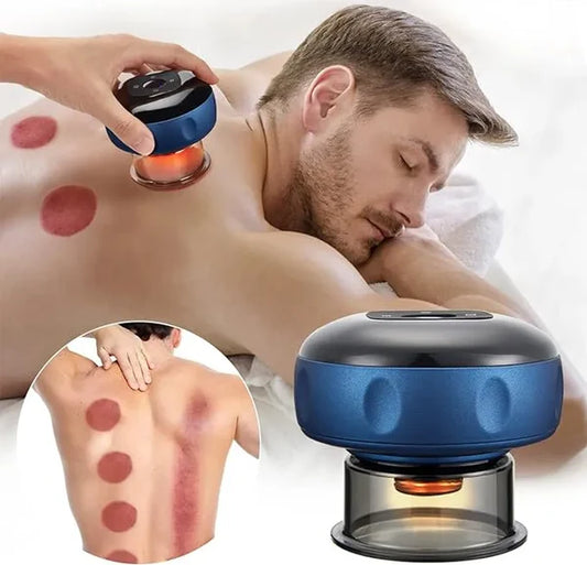 Cupping Therapy Pro™ - Alivio en minutos!